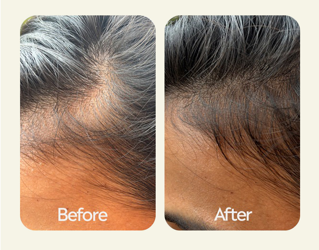 Before and after comparison of hair treatment on a person's head.